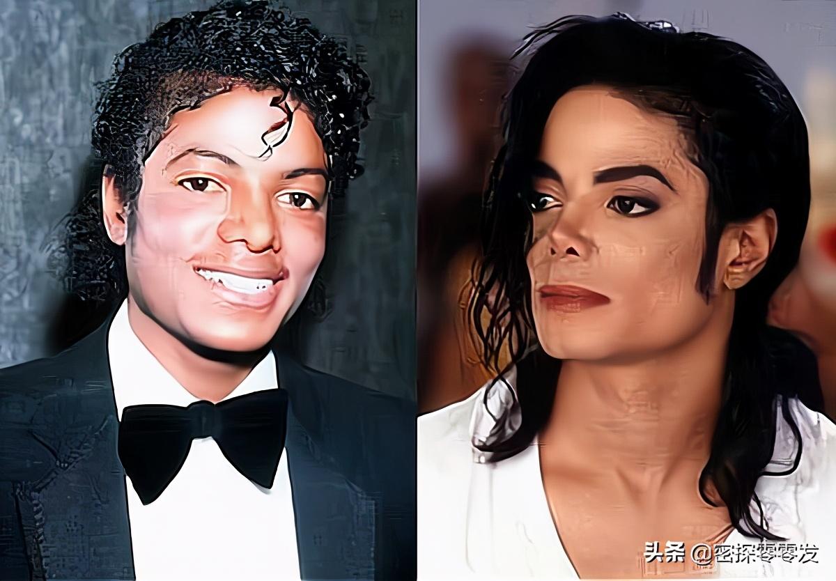 迈克尔杰克逊皮肤怎么变白的(迈克尔·杰克逊真的有漂白吗)插图2